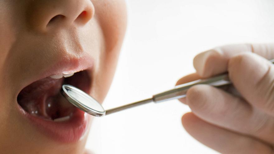 Ein Zahnarztspiegel wird einem Kind in den geöffneten Mund gehalten.