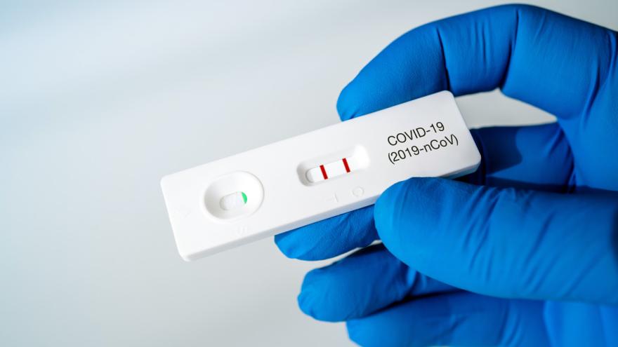 Schnelltests auf Corona: Möglichkeiten zu Hause und von Profis